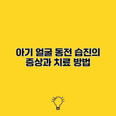 아기 얼굴 동전 습진의 증상과 치료 방법